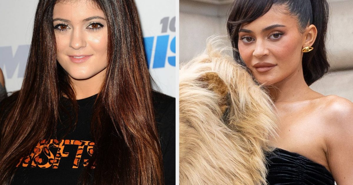 Kylie Jenner Talks Plastic Surgery Regret