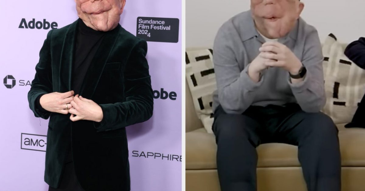 A Different Man’s Adam Pearson On Actors With Disabilites