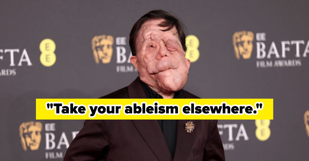 Adam Pearson Responds To Disgusting Online Comments